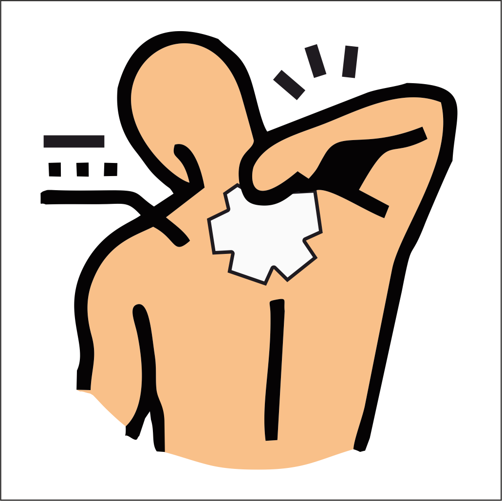 Pain Management